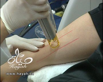 أحدث طرق إزالة الشعر بالليزر hayahcc_1365241170_962.jpg