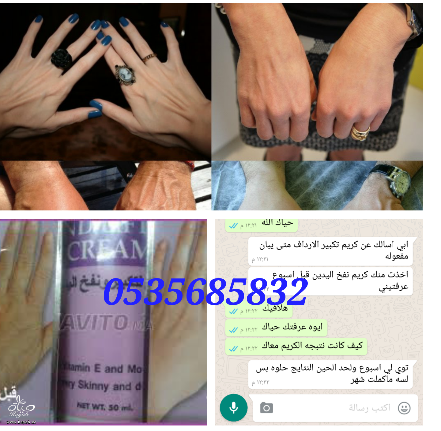 اراء كريم نفخ الكفين واخفاء العروق وتسمين وتبييض اليدين hayahcc_1479751214_529.png