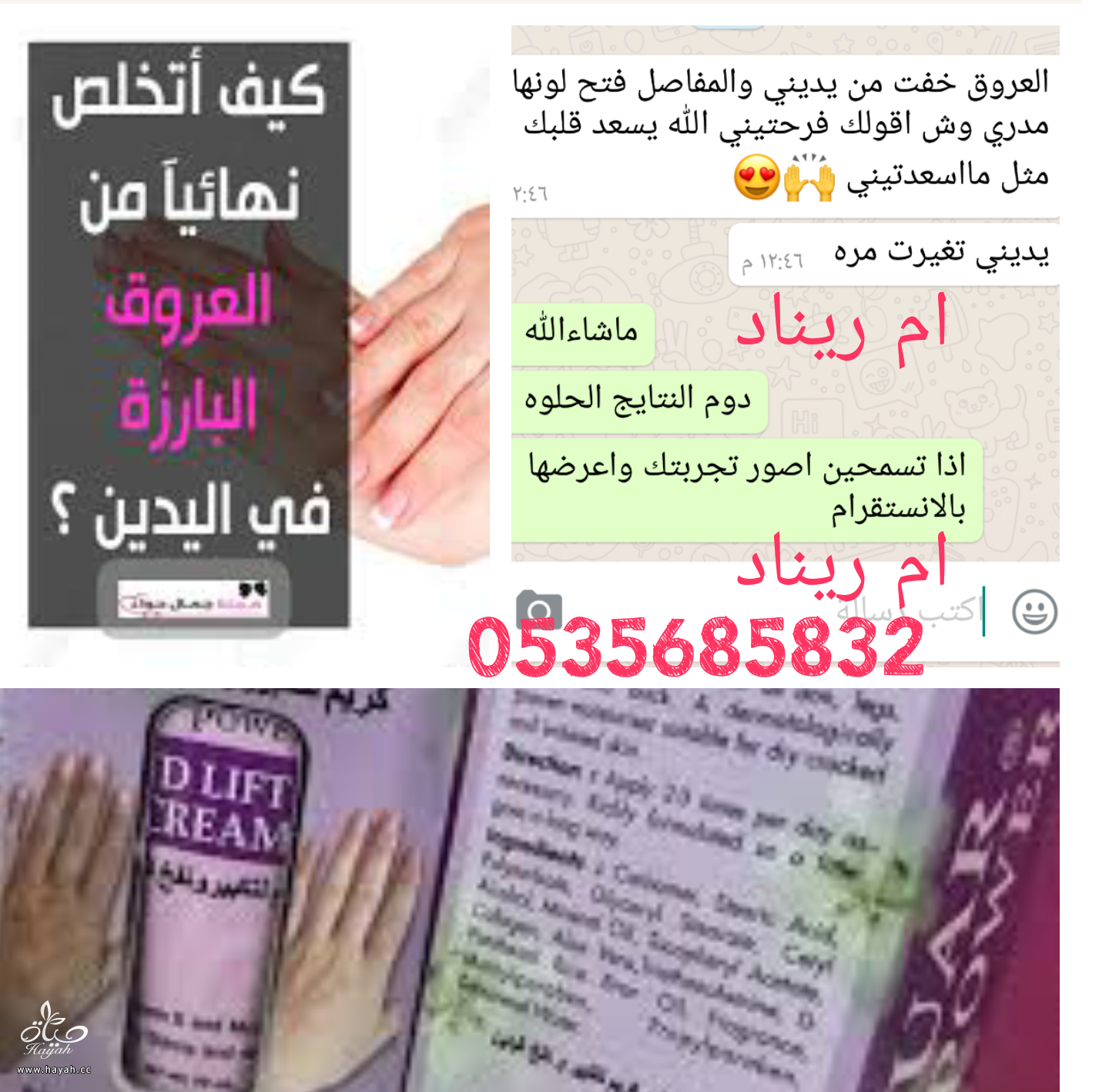 اراء كريم نفخ الكفين واخفاء العروق وتسمين وتبييض اليدين hayahcc_1479751220_850.png